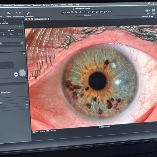 Iris Photography